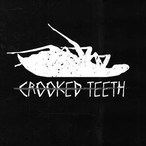 Crooked teeth